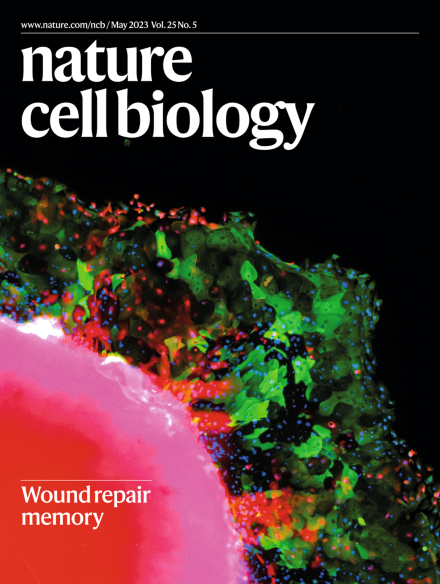 Tissue Memory Relies on Stem Cell Priming in Distal Undamaged Areas