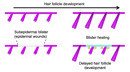 Hair follicle stem cell progeny heal blisters while pausing skin development